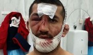 Опубликовано фото подозреваемого в нападении на Расула Мирзаева
