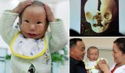 История мальчика, родившегося с "маской" на лице