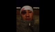 ДВД проверяет обращение алматинца, заявившего об избиении полицейскими