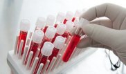 В Федерации биатлона Казахстана объяснили обнаружение запрещенных препаратов