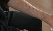 Порезавший руку школьник из Актау рассказал об участии в игре "Синий кит"