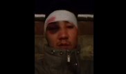 Дело об избиении алматинца: в действиях полицейских нарушений нет - ДВД