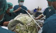 Хирурги нашли клад, вскрыв брюхо 25-летней черепахи