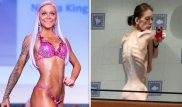 Анорексичка, весившая 25 килограммов, за полтора года стала чемпионкой по бодибилдингу