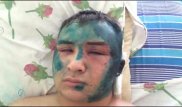 Жестоко избитый житель Балхаша из потерпевшего превратился в подсудимого