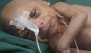 Бенджамин Баттон ХХI века: Мальчик-старик родился в Бангладеш