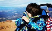 Вопреки прогнозам врачей: мальчику "с двумя лицами" исполнилось 13 лет
