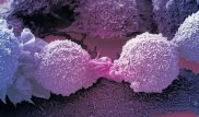 Ученые разработали самые маленькие в мире лазеры для борьбы с раком