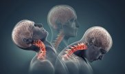 Пораженные раком позвонки заменили напечатанными на 3D-принтере в Китае