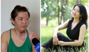 Крик изуродованной казахстанки о помощи услышали за рубежом