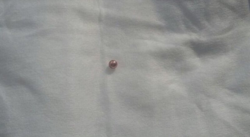 Пуля, извлечённая из головы девочки. Фото с сайта alau.kz