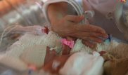 В Индии скончался ребёнок-мутант, которого прозвали "чужим"