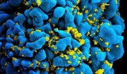 Ученые создали иммунные клетки, способные бороться с ВИЧ