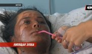 Дело облитой кипящим маслом продавщицы: в МВД сообщили подробности