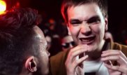 Рэпер Гнойный после избиения дал концерт в маске
