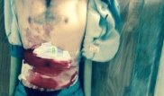 Видео из камеры вспоровшего себе живот чемпиона ММА появилось в Сети