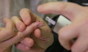 Названа главная ошибка врачей при диагностике диабета