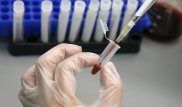 12 детей заболели гепатитом А в ВКО: в Минздраве прокомментировали информацию