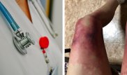 "Долго ждала транспорт". В КАЗГЮУ рассказали о причинах обморожения ног студентки