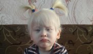 Одна на миллион: как живет девочка-альбинос из Уральска