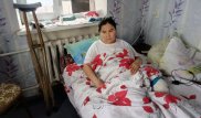 Жительнице Караганды ампутировали ногу через 8 лет после аварии