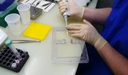 Ученые выяснили, когда люди победят рак и старение