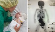 Родители больного раком ребенка предупредили о мошенничестве от их имени