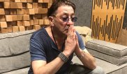 Григорий Лепс госпитализирован со "множественными переломами ребер" - СМИ