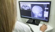 Рак челюсти нашли у алматинцев с вредными привычками - исследование