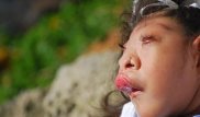 Родившаяся без части мозга девочка умерла в 10 лет