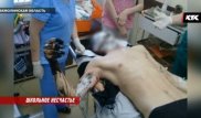 Врачи рассказали о состоянии учителя, обварившегося гудроном
