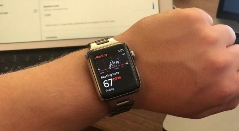 Какие apple watch носят знаменитости