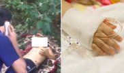 Врачи о ребенке с ВОАД: предстоит пластика головы
