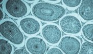 Раскрыт секрет неуязвимости раковых метастазов