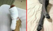 Жена попыталась соблазнить мужа чулками-змеями и оказалась в больнице