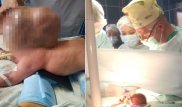 Жылына осындай 2-3 жағдай тіркеледі - Жаңа туған сәбиге күрделі ота жасаған дәрігер
