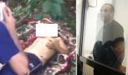 Эксперт по делу мальчика с ВОАД рассказал о травмах ребенка