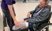 Американец ампутировал себе ногу ножом, чтобы выжить