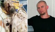 Актюбинский врач рассказал о пациенте, которого мировые СМИ приняли за ожившего мертвеца