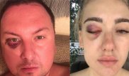 Популярного шоумена избили в собственной квартире в Алматы