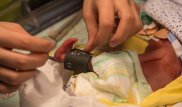 Как врачи помогают недоношенным детям и их родителям