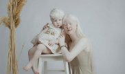 "Откуда у вас такая дочь?" Как живут дети-альбиносы в Казахстане