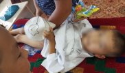 Баланы молда сүндеттесе қандай қауіп бар?