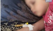 Трещина в черепе. 3-летняя девочка получила травму в детсаду Актобе