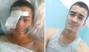 "Солдат самовольно взял гранату" - Минобороны о деле потерявшего руку военнослужащего