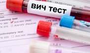 Бесплатно сдать тест на ВИЧ могут казахстанцы