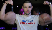 Звезда Интернета лишился "рук-базук"
