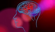 Ученые создали препарат для лечения инсульта