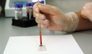 Ученые узнали, как определить продолжительность жизни по анализу крови