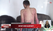 Инвалида заразили гепатитом С в больнице Кокшетау